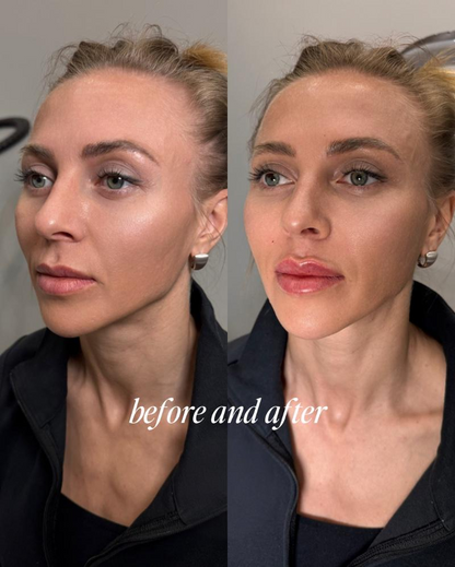 Reedleshot Lip Plumper