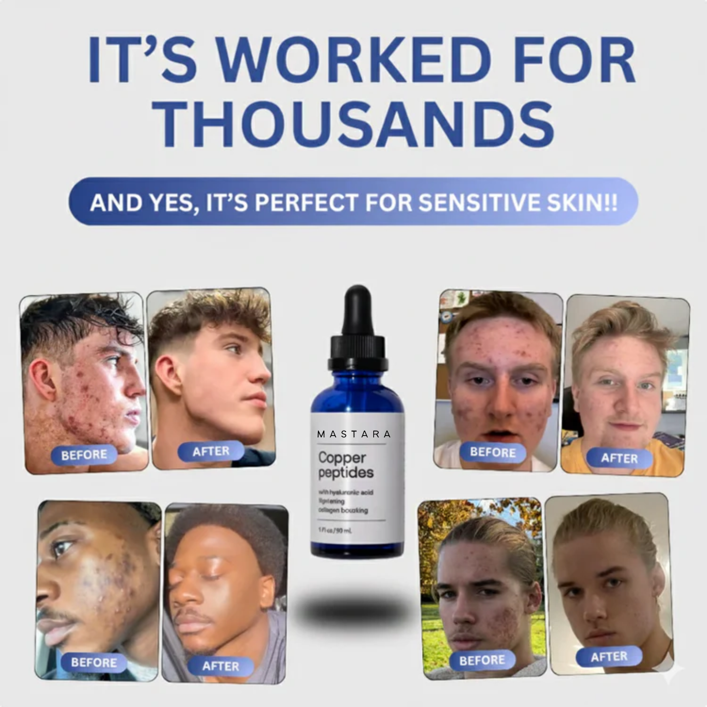 GHK-CU Copper Peptide