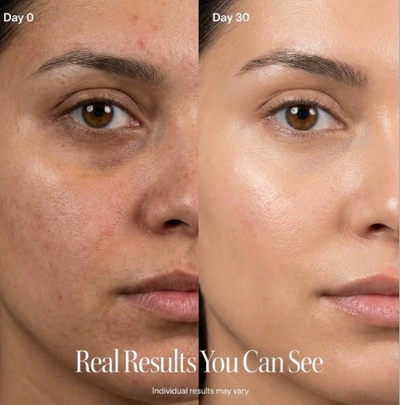 4-In-1 Red Light Therapy V-Face Roller