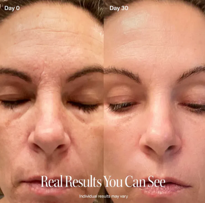 4-In-1 Red Light Therapy V-Face Roller